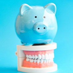 A ceramic model of a jaw and a blue piggy bank